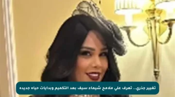 تغيير جذري.. تعرف على ملامح شيماء سيف بعد التكميم وبدايات حياة جديدة